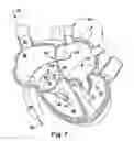 Fig. 08 - Method for implanting a cardiovascular valve