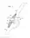 Fig. 02 - Mis patellar preparation