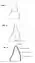 Fig. 02 - Program to make of cutting data for inner face of dental prosthesis