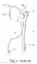 Fig. 02 - Personal audio listening device