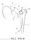 Fig. 03 - Personal audio listening device