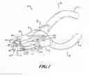 Fig. 02 - Lock washer installation tool