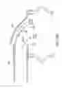 Fig. 09 - Mask assembly