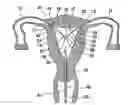 Fig. 01 - Intrauterine fallopian tube occlusion device and method for use
