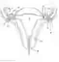 Fig. 01 - Fallopian tube occlusion device