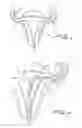 Fig. 02 - Fallopian tube occlusion device