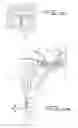 Fig. 06 - Fallopian tube occlusion device