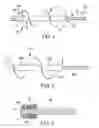 Fig. 02 - Auger