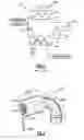 Fig. 02 - Methods and Apparatus For Reducing the Noise Level Outputted by Oil Separator