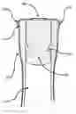 Fig. 01 - DRIP-CATCHING APPARATUS FOR A BOTTLE