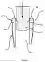 Fig. 07 - DRIP-CATCHING APPARATUS FOR A BOTTLE
