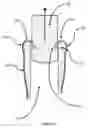 Fig. 08 - DRIP-CATCHING APPARATUS FOR A BOTTLE