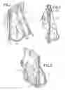 Fig. 02 - COLLAPSIBLE PORTABLE SEAT AND BACKPACK CONSTRUCTION