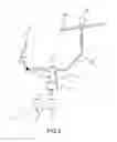 Fig. 03 - Device for compensating for the mechanical play of a helicopter flight control