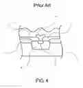 Fig. 05 - CMOS image sensor and method of manufacturing the same