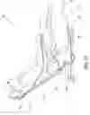 Fig. 13 - Chair arm rest system