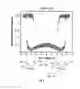 Fig. 08 - Electro-optical measurement of hysteresis in interferometric modulators