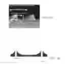Fig. 12 - Methods and configurations for manufacturing hinges for micro-mirror devices