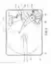 Fig. 07 - Single stopper pin for controlling magnetic head placement in disk drive devices, and methods of making the same