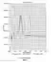 Fig. 02 - Genotyping Hla Loci