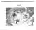 Fig. 01 - Method and quantification assay for determining c-kit/SCF/pAKT status