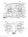 Fig. 04 - Retractor device for cervical spinal fusion