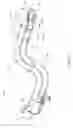 Fig. 02 - WIRE-GUIDED CURETTE