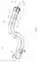Fig. 04 - WIRE-GUIDED CURETTE