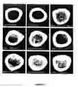 Fig. 07 - METHOD FOR FOSTERING BONE FORMATION AND PRESERVATION