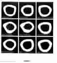 Fig. 08 - METHOD FOR FOSTERING BONE FORMATION AND PRESERVATION