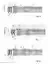 Fig. 04 - Dispensing Device For Delivering Fluid Having a Dosing Chamber and a Slide Valve Assemly