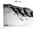 Fig. 40 - Methods And Devices For Fractional Ablation Of Tissue