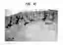 Fig. 41 - Methods And Devices For Fractional Ablation Of Tissue