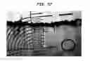 Fig. 53 - Methods And Devices For Fractional Ablation Of Tissue