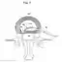 Fig. 08 - Styli used to position device for carrying out selective discetomy