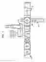 Fig. 09 - Linked tibial resection guide