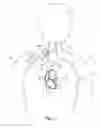 Fig. 02 - DIRECT DELIVERY SYSTEM FOR TRANSVASCULAR LEAD