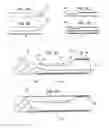 Fig. 03 - CONTRALATERAL INSERTION METHOD TO TREAT HERNIATION WITH DEVICE USING VISUALIZATION COMPONENTS