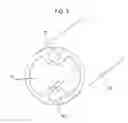 Fig. 04 - CONTRALATERAL INSERTION METHOD TO TREAT HERNIATION WITH DEVICE USING VISUALIZATION COMPONENTS