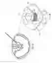 Fig. 05 - CONTRALATERAL INSERTION METHOD TO TREAT HERNIATION WITH DEVICE USING VISUALIZATION COMPONENTS