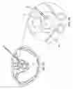 Fig. 06 - CONTRALATERAL INSERTION METHOD TO TREAT HERNIATION WITH DEVICE USING VISUALIZATION COMPONENTS