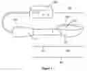 Fig. 02 - METHOD OF SELECTIVE AND CONTAINED ULTRASOUND DEBRIDEMENT