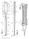 Fig. 02 - Blood vessel occluder and method of use