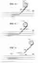 Fig. 06 - Intravenous deep vein thrombosis filter and method of filter placement