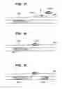 Fig. 07 - Intravenous deep vein thrombosis filter and method of filter placement