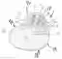 Fig. 01 - Insert molded shroud for implantable plate-type electrodes