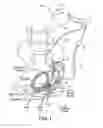 Fig. 02 - Method, system and device for treating disorders of the pelvic floor by electrical stimulation of the sacral and/or pudendal nerves