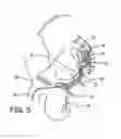 Fig. 06 - Method, system and device for treating disorders of the pelvic floor by electrical stimulation of the sacral and/or pudendal nerves