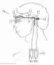 Fig. 01 - Vision regeneration assisting apparatus