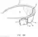 Fig. 06 - Field of view matching in a visual prosthesis